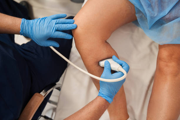 Venous Insufficiency Treatment in Stuart, FL