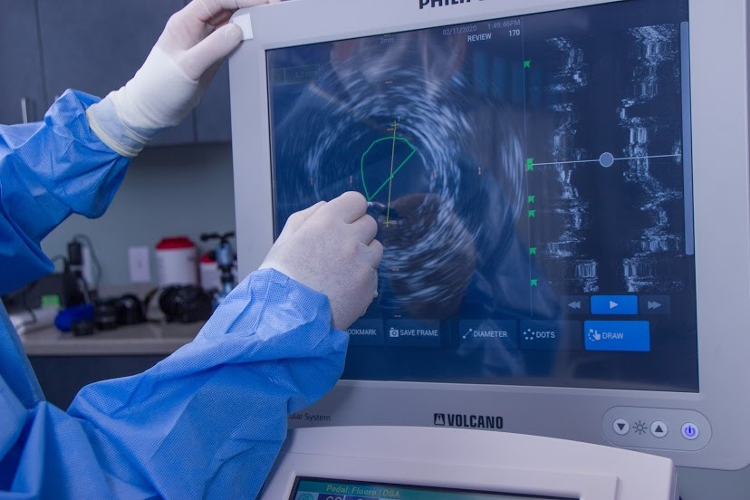 Carotid Artery Disease Treatment in Stuart, Florida