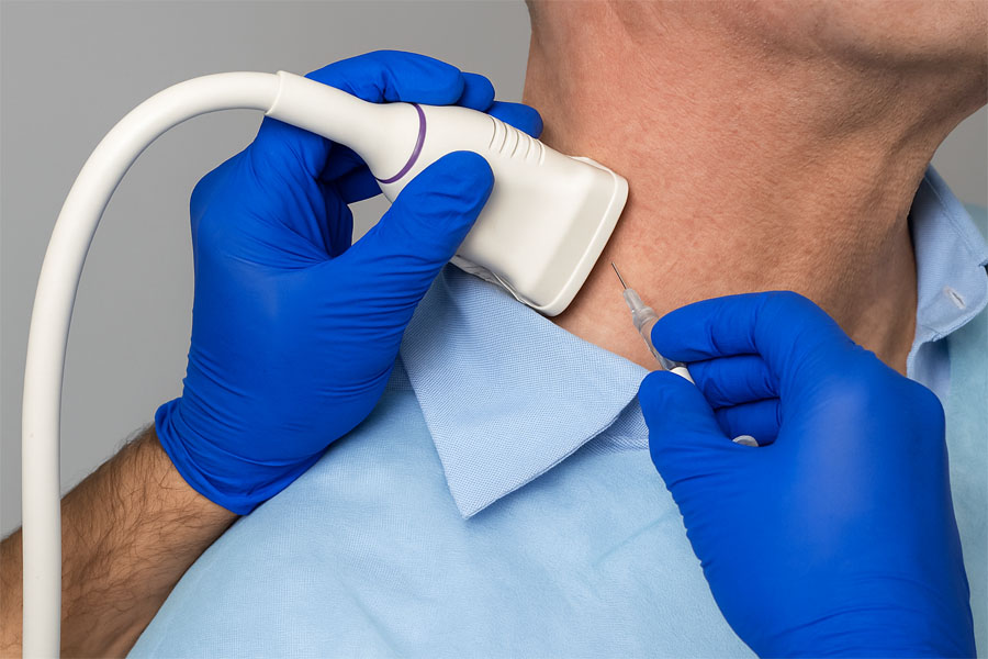 Carotid Artery Health Screening in Indiantown, FL