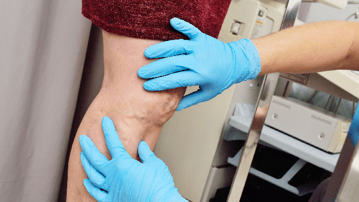 Advanced Endovascular Care in Hobe Sound, FL Symmetry Vascular Center