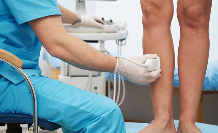 Non-Surgical Vein Treatment in Port St. Lucie, FL